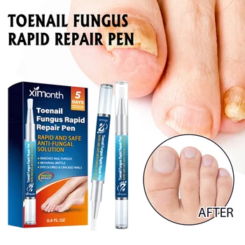 Ручка для ремонта ногтей Ximonth, Восстанавливающая утолщение инкрустированных ногтей, увлажняющая омертвевшую кожу рук и серый уход за ногтями
